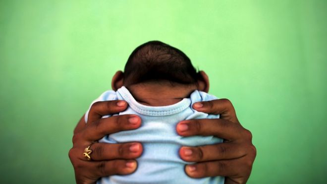 Bebê com microcefalia, de costas, é erguido por mão adulta