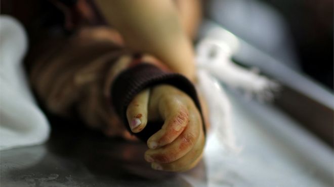 جثمان الطفلة الفلسطينية صبا أبو عرار ، 14 شهرًا ، في مشرحة في مدينة غزة في 4 مايو 2019