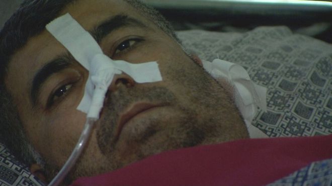 Абдул Рашид, пострадавший в результате взрыва бомбы в Кабуле
