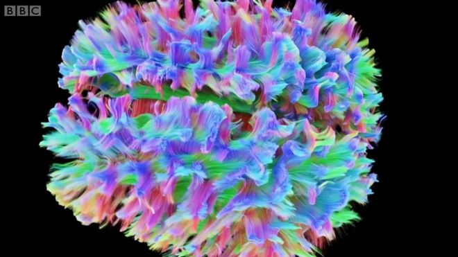 Детализированная 3d-модель мозга человека отражает направление движения информации по волокнам.