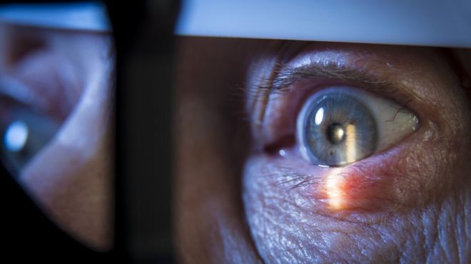 Глазные осмотры с помощью щелевой лампы можно использовать для выявления состояний, включая глаукому