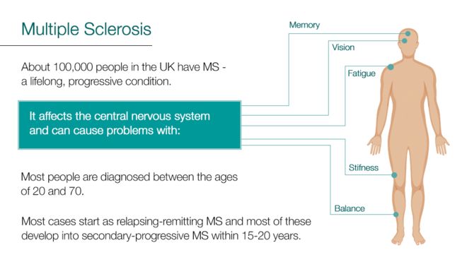Графические данные о симптомах рассеянного склероза, которые включают проблемы с: зрением, равновесием, усталостью, скованностью, памятью