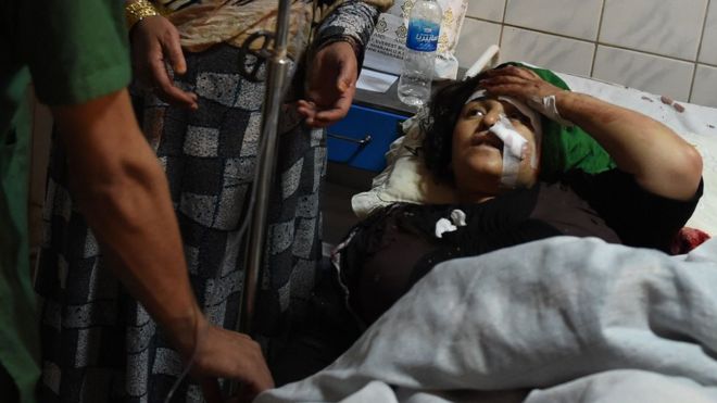 Афганская женщина получает лечение в больнице Али-Абад после нападения внутри храма Карт-э-Сахи в Кабуле 11 октября