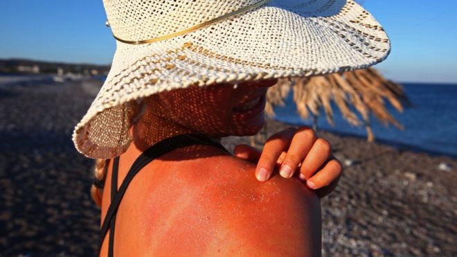 Woman with peeling skin