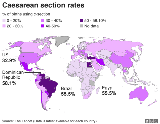 На графике показаны показатели кесарева сечения по всему миру с использованием данных за 2015 год