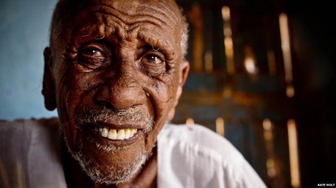 Пожилой мужчина, у которого обнаружена трахома, позирует фотографу