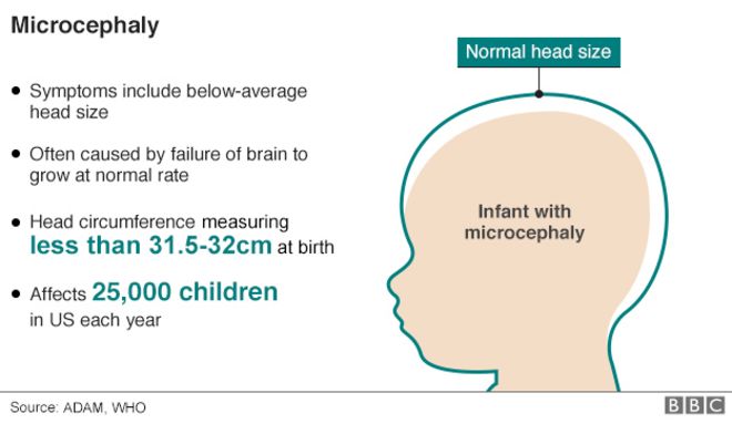 Графика, показывающая размер головы ребенка