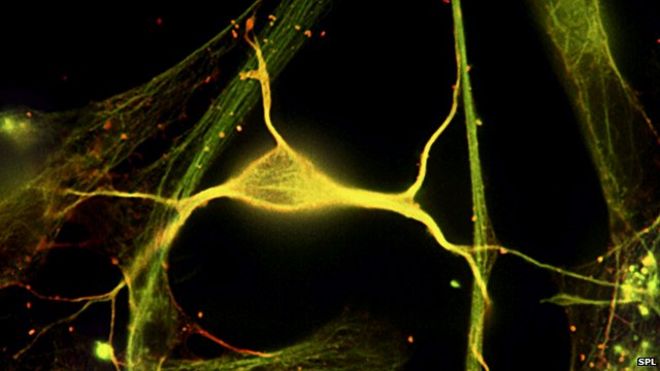 одиночный нейрон в гиппокампе