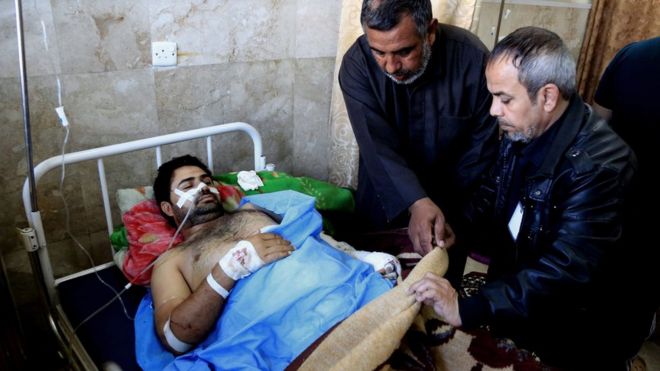 Раненая жертва теракта-самоубийства в Садр-Сити, Багдад, находится на лечении в больнице (29 февраля 2016 года)