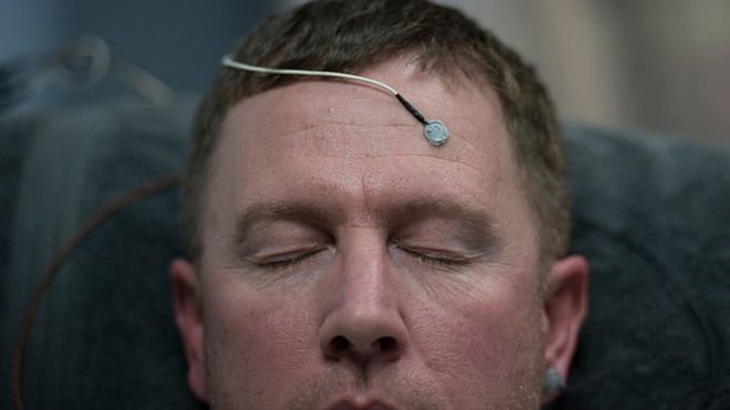 Hombre con un sensor en la cabeza