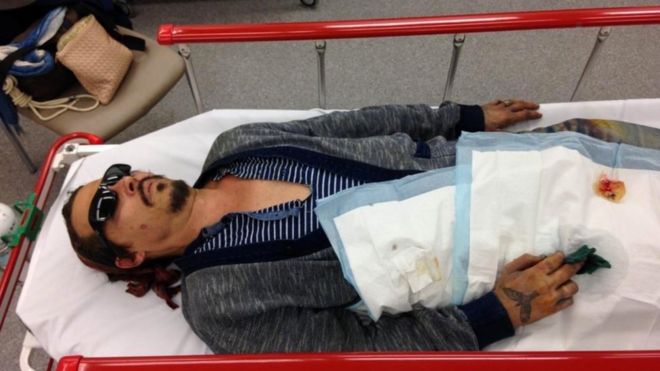 Джонни Депп лежит на носилках с поврежденным пальцем