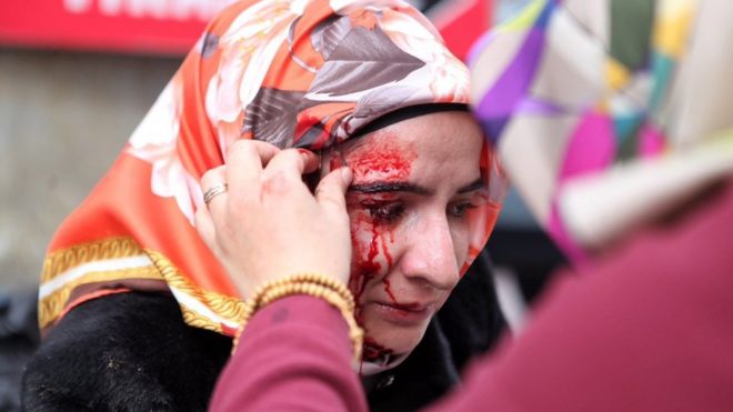 A handout picture released by the Zaman Daily News shows a wounded woman being helped by her friends during a protest outside of Zaman newspaper building, in Istanbul, Turkey, 05 March 2016