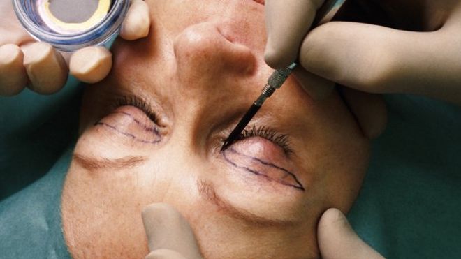 Человек, имеющий косметическую операцию на лице