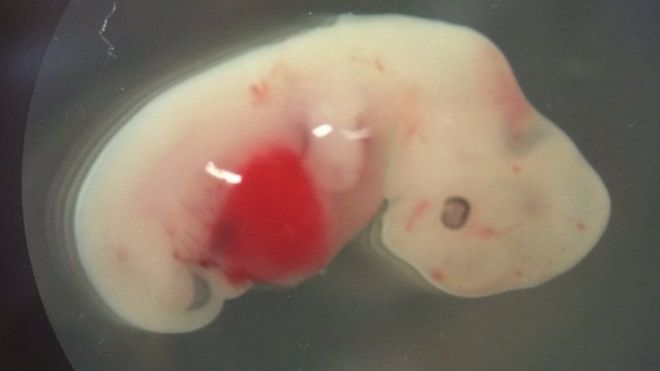 Embrión de cuatro semanas