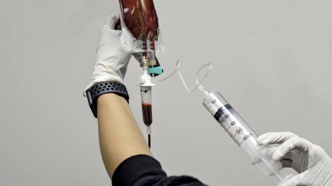 Pessoa aplicando seringa de ozônio em bolsa de sangue