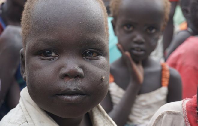 Недоедающие дети в месте защиты Бентиу