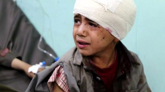 غارات جوية شنها التحالف بقيادة السعودية تقتل عشرات الأشخاص بينهم أطفال،في مدينة صعدة شمال اليمن، حسبما ذكرت مصادر طبية واللجنة الدولية للصليب الأحمر، الخميس.