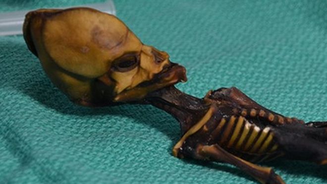 ДНК анализа открила је узрок необичног облика овог скелета