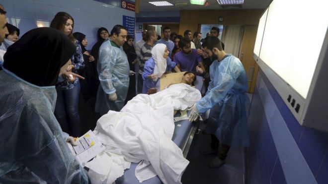 Медики помогают раненому ребенку в больнице после того, как террористы-смертники напали на южные пригороды Бейрута (12 ноября 2015 года)