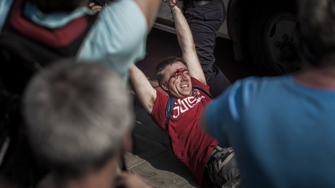 Избитый человек