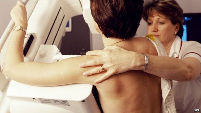 Breast cancer screening involves mammogram scans
