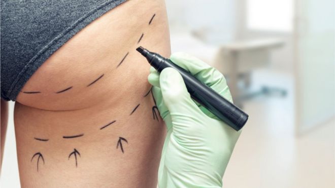 Pastillas para adelgazar sin liposucciones