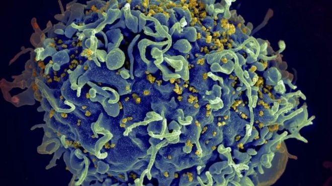 Electromicrografía que muestra al virus VIH infectando una célula humana