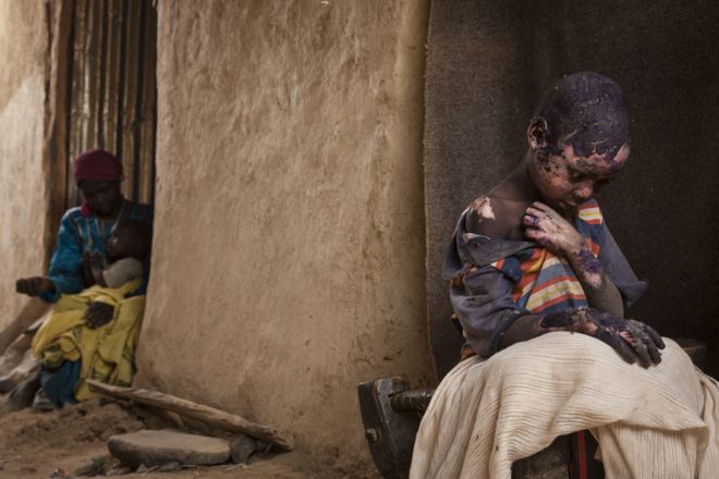 Адриана Оганесян, США, 2015, Забытые горы Судана