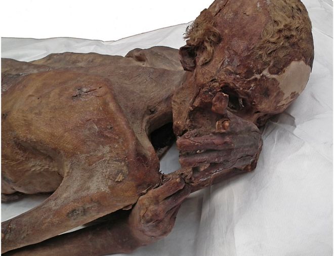 Male Mummy