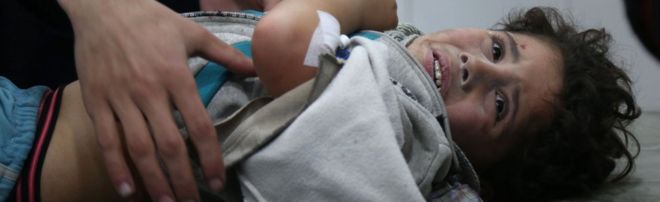Ребенок в больнице в Восточной Гуте