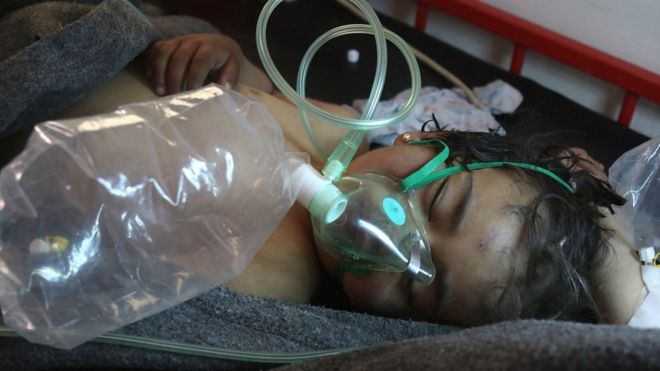 Niña en Siria, afectada por un ataque, recibe oxígeno mediante una máscara