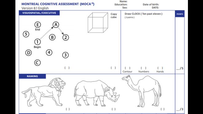 Пример нейропсихологического теста Монреальской когнитивной оценки (МОКА)