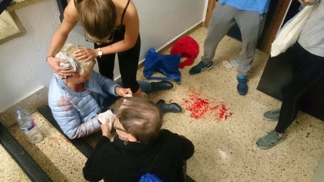 Женщина ранена на лестнице, а другой человек частично покрывает ее голову тканью, в Барселоне, Испания, 1 октября 2017 года