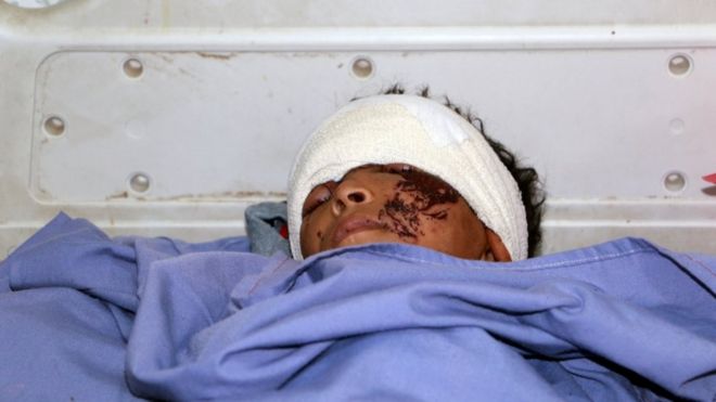 طفل اصيب في هجوم صعدة