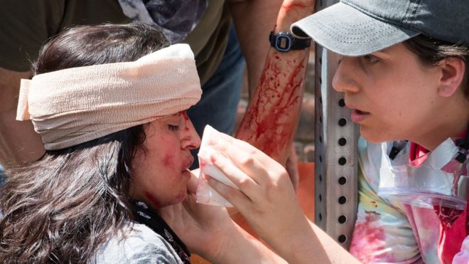 Женщина получает первую медицинскую помощь после того, как в Шарлоттсвилле столкнулась автомобильная авария с толпой протестующих