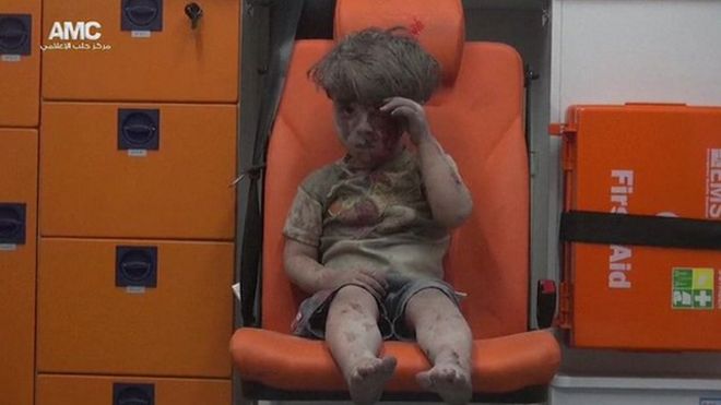 Мальчик, спасенный из-под развалин в Алеппо