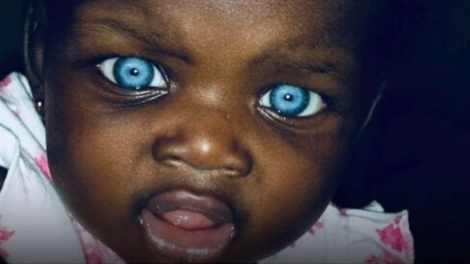 blue eyed girl