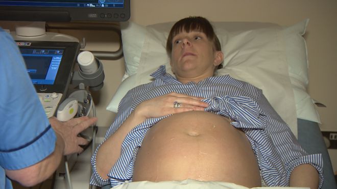 Услуги по беременности и родам у доктора Грея в Морее были понижены в июле