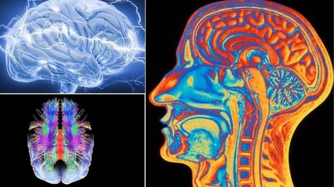 Различные научные образы мозгов