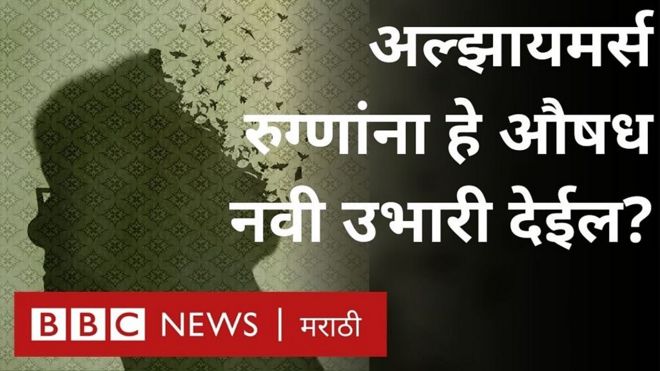 अल्झायमर्स
