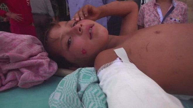 Niño herido en Siria