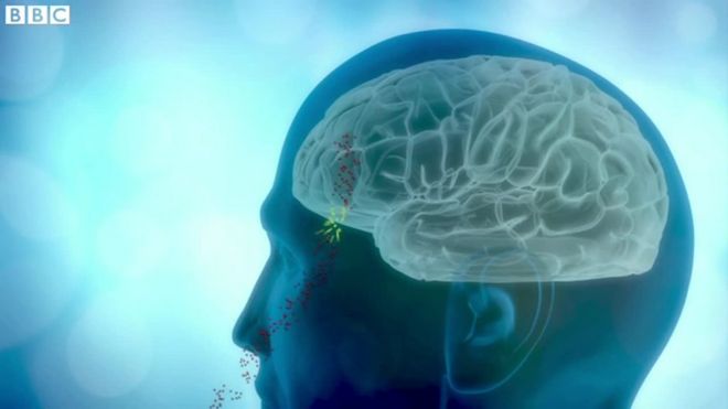 大気汚染物質が脳の組織に蓄積されていることが英大学の研究で確認され、アルツハイマー病などの認知症との関連が疑われている。