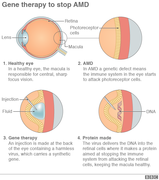 График, показывающий, как работает процесс генной терапии