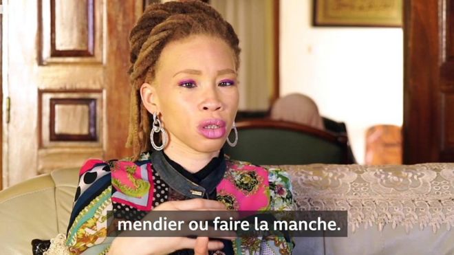 Sénégal -Maah Khoudia : "Je souffre d’albinisme mais je ne suis pas handicapée"