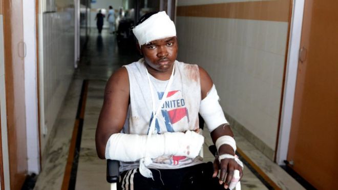 Выносливость Амарава была допущена в больницу после нападения в понедельник вечером на африканских граждан в Большой Нойде