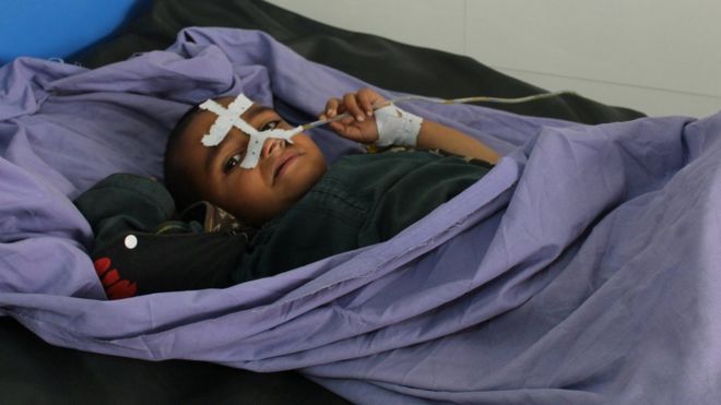 An Afghan child receives treatment at a hospital in Kunduz province, Afghanistan, 3 April 2018
