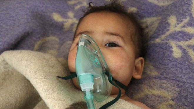 Criança síria recebe tratamento após suposto ataque químico em Khan Sheikhoun no dia 4 de abril de 2017