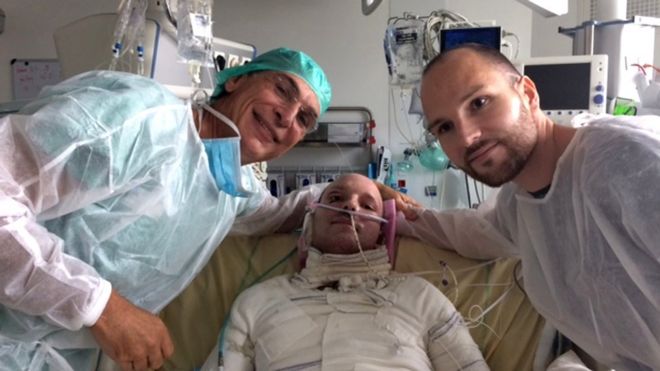 Maurice Mimounel, a cargo de la operación, Franck (el paciente) y su hermano gemelo Eric (el donante).