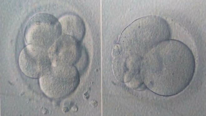 Неудачные эмбрионы Стейси Освин
