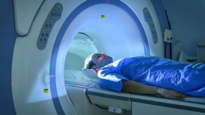 Pindaian MRI dapat menunjukkan cedera yang diakibatkan Covid panjang.